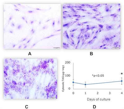 Transcriptome Modifications in Porcine Adipocytes via Toll-Like Receptors Activation